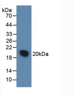 IL1RN Protein - Active Interleukin 1 Receptor Antagonist (IL1RA) by WB