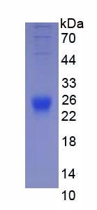 IL2 Protein - Eukaryotic Interleukin 2 (IL2) by SDS-PAGE