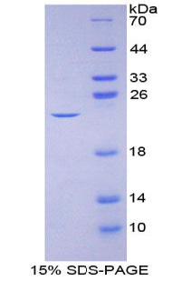 IL2 Protein - Recombinant Interleukin 2 By SDS-PAGE