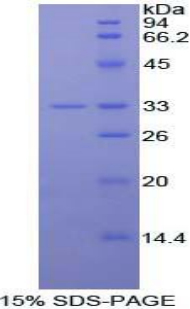 IL20RA Protein - Recombinant Interleukin 20 Receptor Alpha By SDS-PAGE