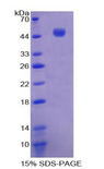IL21 Protein - Recombinant Interleukin 21 By SDS-PAGE