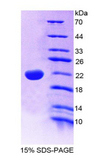 IL22 Protein - Recombinant  Interleukin 22 By SDS-PAGE