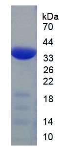 IL23A / IL-23 p19 Protein - Recombinant Interleukin 23 (IL23) by SDS-PAGE