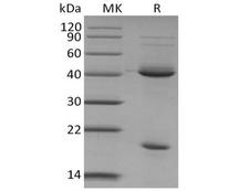 IL23A / IL-23 p19 Protein - Recombinant Mouse IL-23