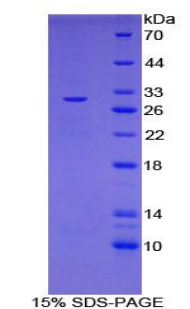IL27RA Protein - Recombinant Interleukin 27 Receptor Alpha By SDS-PAGE