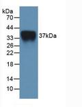 IL2RA / CD25 Protein - Active Interleukin 2 Receptor Alpha (IL2Ra) by WB