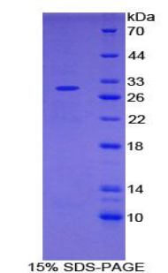 IL2RA / CD25 Protein - Recombinant Interleukin 2 Receptor Alpha By SDS-PAGE