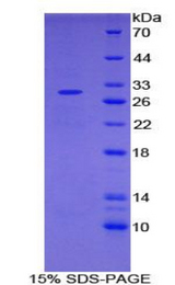 IL2RA / CD25 Protein - Recombinant Interleukin 2 Receptor Alpha By SDS-PAGE