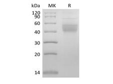 IL2RB / CD122 Protein - Recombinant Mouse IL-2 Receptor Subunit Beta/IL-2RB/CD122 (C-6His)