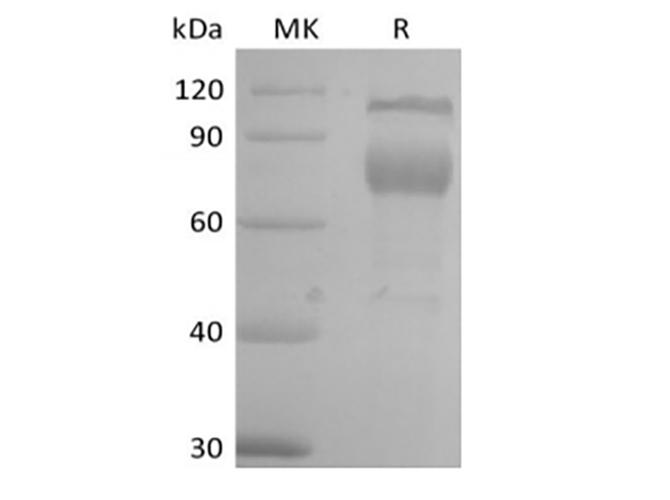 IL2RB / CD122 Protein - Recombinant Mouse IL-2 Receptor Subunit Beta/IL-2RB/CD122 (C-Fc)