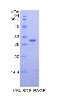 IL2RB / CD122 Protein