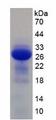 IL2RB / CD122 Protein - Recombinant Interleukin 2 Receptor Beta By SDS-PAGE