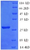 IL2RB / CD122 Protein