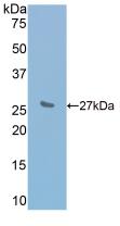 IL2RB / CD122 Protein - Active Interleukin 2 Receptor Beta (IL2Rb) by WB