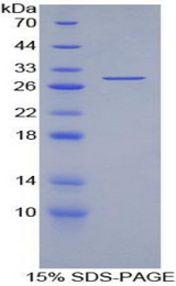 IL2RG / CD132 Protein - Recombinant Interleukin 2 Receptor Gamma By SDS-PAGE