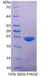 IL36RN / IL1F5 Protein - Recombinant Interleukin 1 Delta By SDS-PAGE