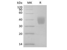 IL4R / CD124 Protein - Recombinant Mouse IL-4RA (C-6His)