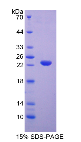IL5RA / CD125 Protein - Recombinant  Interleukin 5 Receptor Alpha By SDS-PAGE