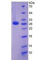 IL6 / Interleukin 6 Protein - Recombinant Interleukin 6 By SDS-PAGE