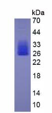 IL6 / Interleukin 6 Protein - Active Interleukin 6 (IL6) by SDS-PAGE