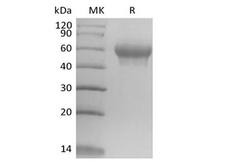 IL6R / IL6 Receptor Protein - Recombinant Mouse IL-6 Receptor Subunit alpha/IL-6RA/CD126 (C-6His)