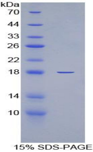 IL6R / IL6 Receptor Protein - Recombinant Interleukin 6 Receptor By SDS-PAGE