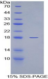 IL6R / IL6 Receptor Protein - Recombinant Interleukin 6 Receptor By SDS-PAGE
