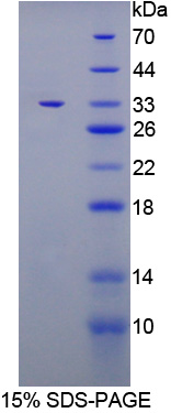 IL6ST / CD130 / gp130 Protein - Recombinant  Glycoprotein 130 By SDS-PAGE