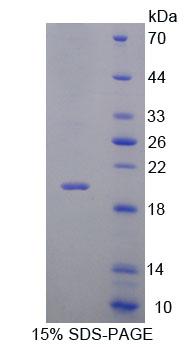 IL7R / CD127 Protein - Recombinant Interleukin 7 Receptor By SDS-PAGE