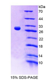 IL9R / CD129 Protein - Recombinant  Interleukin 9 Receptor By SDS-PAGE