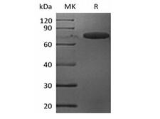ILT3 / LILRB4 Protein - Recombinant Mouse Leukocyte Ig-Like Receptor B4/LILRB4/CD85k/ILT3 (C-Fc)