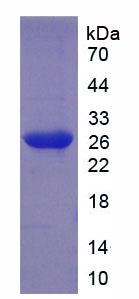 ILT3 / LILRB4 Protein - Recombinant Leukocyte Immunoglobulin Like Receptor Subfamily B, Member 4 By SDS-PAGE