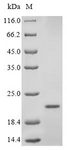 Insulin Protein - (Tris-Glycine gel) Discontinuous SDS-PAGE (reduced) with 5% enrichment gel and 15% separation gel.