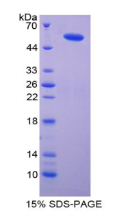 IPO8 / Importin 8 Protein - Recombinant Importin 8 By SDS-PAGE