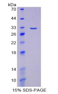 IRF5 Protein - Recombinant Interferon Regulatory Factor 5 By SDS-PAGE