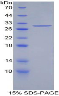 IRS1 Protein - Recombinant Insulin Receptor Substrate 1 By SDS-PAGE