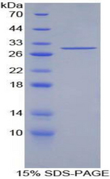 IRS1 Protein - Recombinant Insulin Receptor Substrate 1 By SDS-PAGE