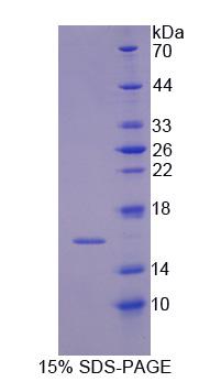 IRS4 Protein - Recombinant Insulin Receptor Substrate 4 (IRS4) by SDS-PAGE