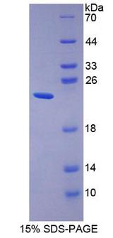 ISG15 Protein - Recombinant Ubiquitin Cross Reactive Protein By SDS-PAGE