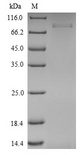 ISM1 Protein - (Tris-Glycine gel) Discontinuous SDS-PAGE (reduced) with 5% enrichment gel and 15% separation gel.