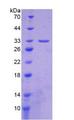 ITGA1/CD49a/Integrin Alpha 1 Protein - Recombinant Integrin Alpha 1 By SDS-PAGE