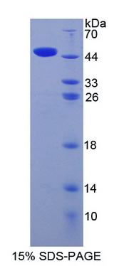 ITGA2 / CD49b Protein - Recombinant  Integrin Alpha 2 By SDS-PAGE