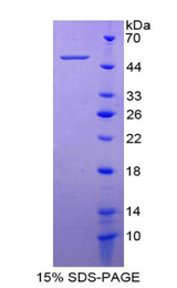 ITGA5/Integrin Alpha 5/CD49e Protein - Recombinant Integrin Alpha 5 By SDS-PAGE