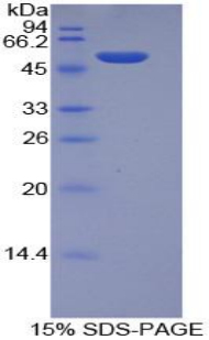 ITGA6/Integrin Alpha 6/CD49f Protein - Recombinant Integrin Alpha 6 By SDS-PAGE
