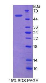 ITGAX / CD11c Protein - Recombinant  Integrin Alpha X By SDS-PAGE
