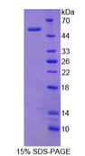 ITGAX / CD11c Protein - Recombinant  Integrin Alpha X By SDS-PAGE