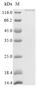 ITGAX / CD11c Protein - (Tris-Glycine gel) Discontinuous SDS-PAGE (reduced) with 5% enrichment gel and 15% separation gel.