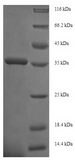 ITGB1 / Integrin Beta 1 / CD29 Protein - (Tris-Glycine gel) Discontinuous SDS-PAGE (reduced) with 5% enrichment gel and 15% separation gel.