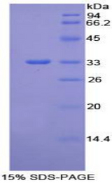 ITGB1 / Integrin Beta 1 / CD29 Protein - Recombinant Integrin Beta 1 By SDS-PAGE