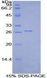 ITGB2 / CD18 Protein